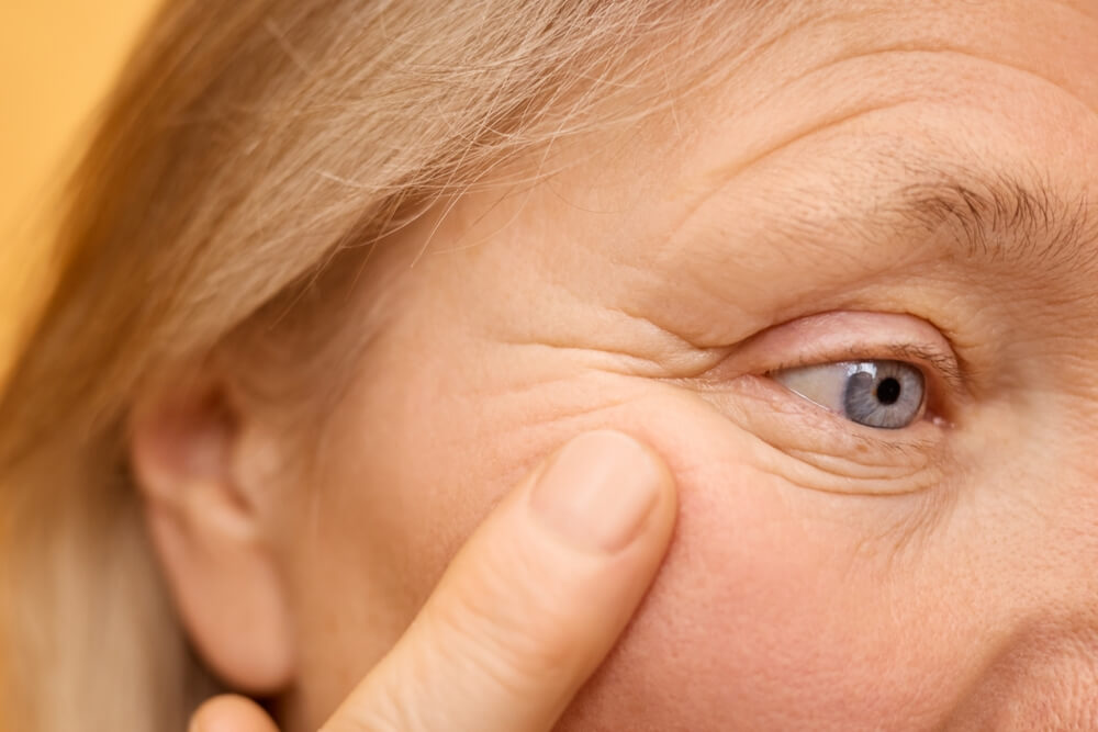 ริ้วรอยบนใบหน้า วิธีแก้